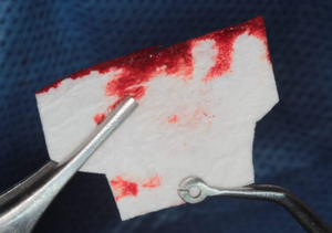 CollaShield™ Collagen Membrane